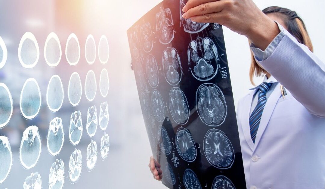 What is Traumatic Brain Injury (TBI)?