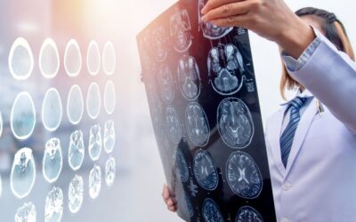 What is Traumatic Brain Injury (TBI)?